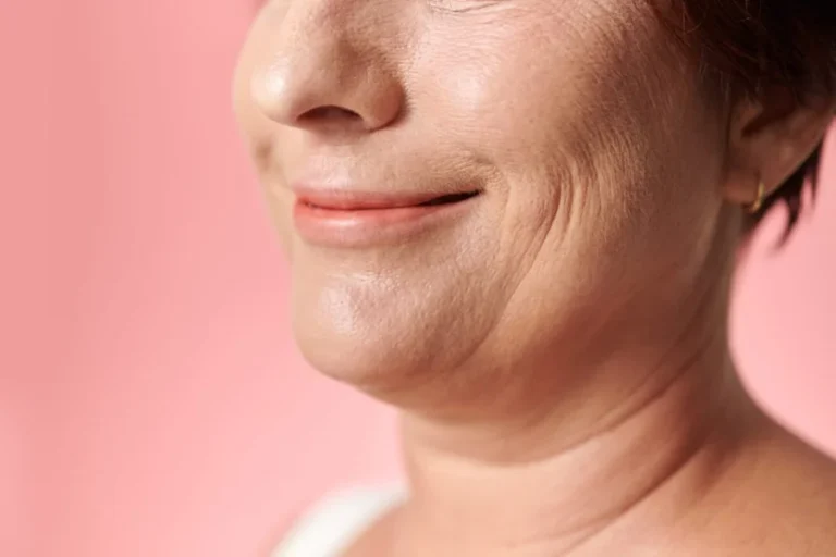 Effective Ways on How to Get Rid of Jowls